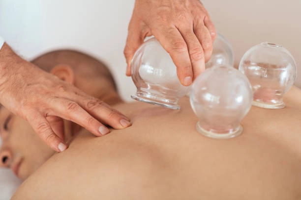 Best practices of cupping in St. Louis, MO, choose Elev8